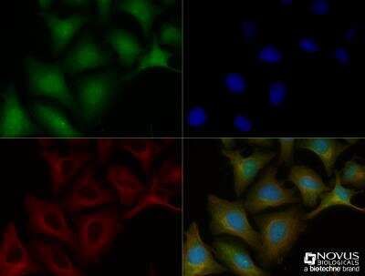 Immunocytochemistry/ Immunofluorescence: C9orf72 Antibody - BSA Free [NBP2-47146]