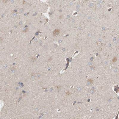 Immunohistochemistry-Paraffin: C9orf72 Antibody [NBP1-93504]
