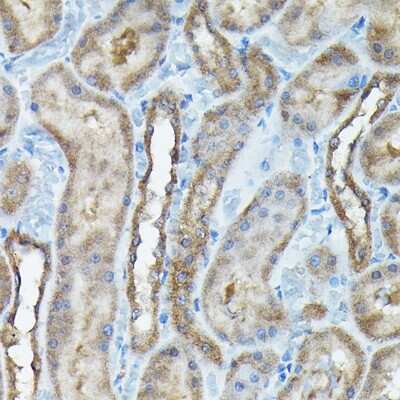 Immunohistochemistry-Paraffin: C9orf72 Antibody - Azide and BSA Free [NBP2-92755]