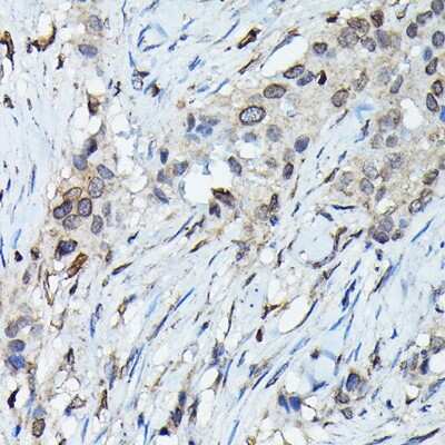 Immunohistochemistry-Paraffin: C9orf72 Antibody - Azide and BSA Free [NBP2-92755]