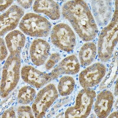 Immunohistochemistry-Paraffin: C9orf72 Antibody - Azide and BSA Free [NBP2-92755]