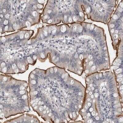 Immunohistochemistry-Paraffin: SPATA31E1 Antibody [NBP1-93822]
