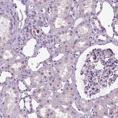 Immunohistochemistry-Paraffin: SPATA31E1 Antibody [NBP1-93822]