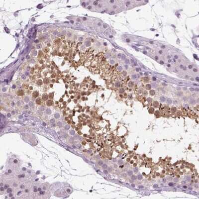 Immunohistochemistry-Paraffin: SPATA31E1 Antibody [NBP1-93822]