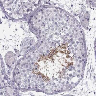 Immunohistochemistry-Paraffin: C9orf9 Antibody [NBP1-90933]