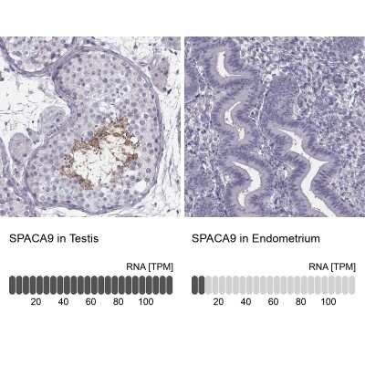 Immunohistochemistry-Paraffin: C9orf9 Antibody [NBP1-90933]
