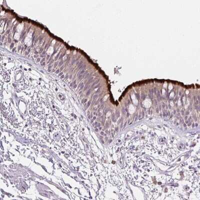 Immunohistochemistry-Paraffin: C9orf9 Antibody [NBP2-58670]