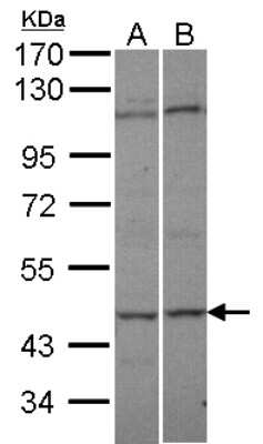 Western Blot: Adenylate Kinase 8 Antibody [NBP1-32319]