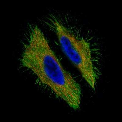 Immunocytochemistry/ Immunofluorescence: CA125/MUC16 Antibody (CL2782) [NBP2-59023]