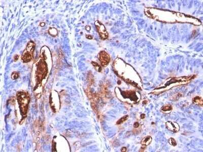 Immunohistochemistry-Paraffin: CA19-9/Sialyl Lewis A Antibody (SPM588) - IHC-Prediluted [NBP2-48432]