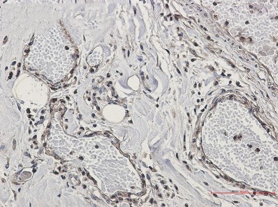 Immunohistochemistry-Paraffin: CAB39 Antibody (S03-4G7) [NBP3-19841]