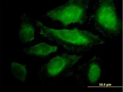 Immunocytochemistry/ Immunofluorescence: CABLES1 Antibody [H00091768-B01P]