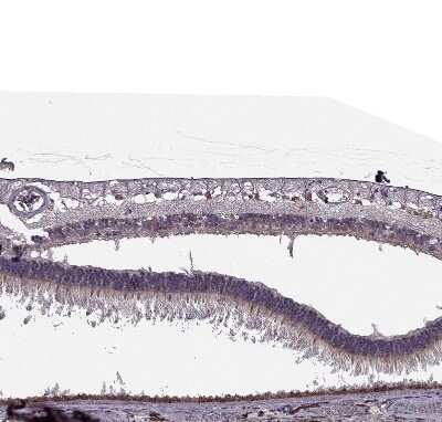Immunohistochemistry-Paraffin: CABP5 Antibody [NBP1-86691]