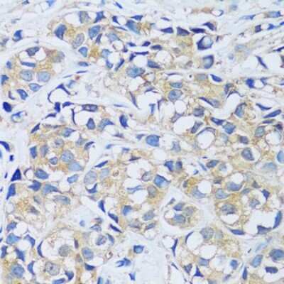 Immunohistochemistry-Paraffin: CABP7 Antibody - Azide and BSA Free [NBP2-92722]