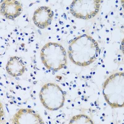 Immunohistochemistry-Paraffin: CABP7 Antibody - Azide and BSA Free [NBP2-92722]