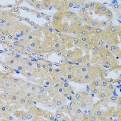Immunohistochemistry-Paraffin: CABP7 Antibody - Azide and BSA Free [NBP2-92722]