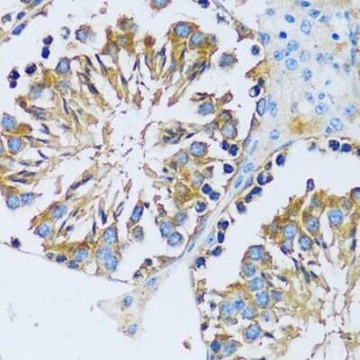Immunohistochemistry-Paraffin: CABP7 Antibody - Azide and BSA Free [NBP2-92722]