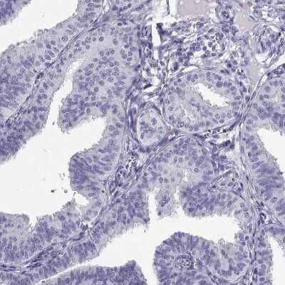 Immunohistochemistry-Paraffin: CABS1 Antibody [NBP1-91743]