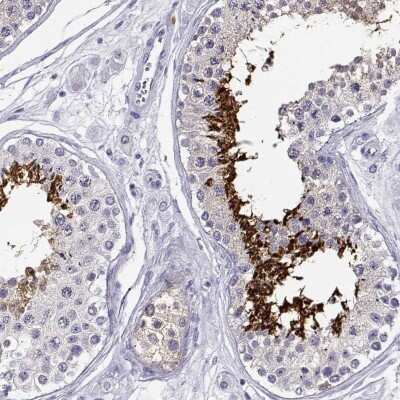 Immunohistochemistry-Paraffin: CABS1 Antibody [NBP1-91743]