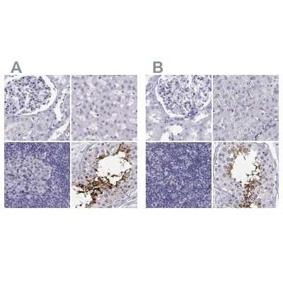Immunohistochemistry-Paraffin: CABS1 Antibody [NBP1-91743]