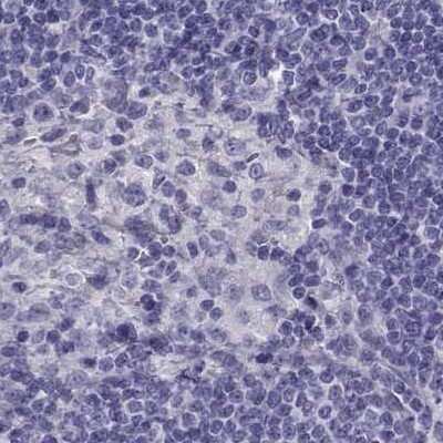Immunohistochemistry-Paraffin: CABS1 Antibody [NBP1-91743]