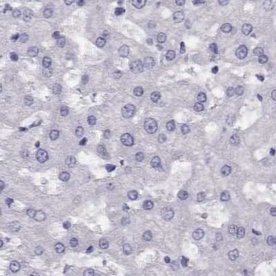 Immunohistochemistry-Paraffin: CABS1 Antibody [NBP1-91743]
