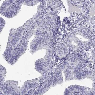 Immunohistochemistry-Paraffin: CABS1 Antibody [NBP2-33750]