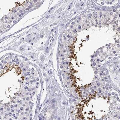 Immunohistochemistry-Paraffin: CABS1 Antibody [NBP2-33750]