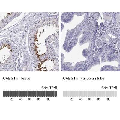 Immunohistochemistry-Paraffin: CABS1 Antibody [NBP2-33750]