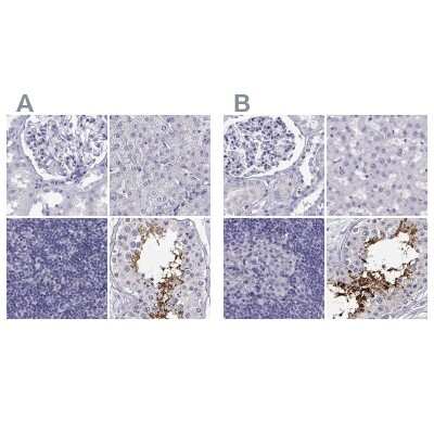 Immunohistochemistry-Paraffin: CABS1 Antibody [NBP2-33750]