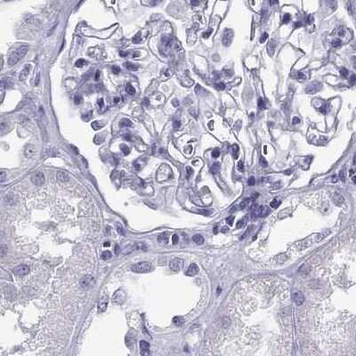 Immunohistochemistry-Paraffin: CABS1 Antibody [NBP2-33750]