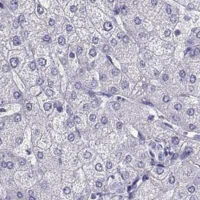 Immunohistochemistry-Paraffin: CABS1 Antibody [NBP2-33750]