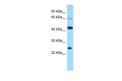 Western Blot: CABS1 Antibody [NBP3-10715]