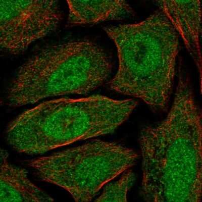 Immunocytochemistry/ Immunofluorescence: CABYR Antibody [NBP2-14430]