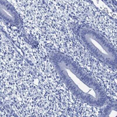 Immunohistochemistry-Paraffin: CABYR Antibody [NBP2-14429]