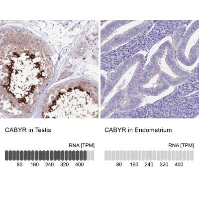 Immunohistochemistry-Paraffin: CABYR Antibody [NBP2-14430]