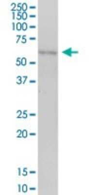 Western Blot: CABYR Antibody [H00026256-B01P]
