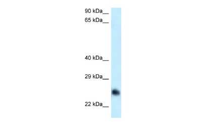 Western Blot: CABYR Antibody [NBP2-87108]