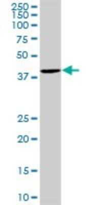 Western Blot: CAC1 Antibody [H00143384-B01P]