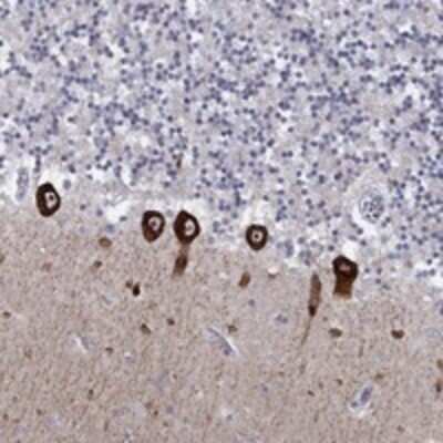 Immunohistochemistry-Paraffin: CACNA1A Antibody [NBP3-17155]