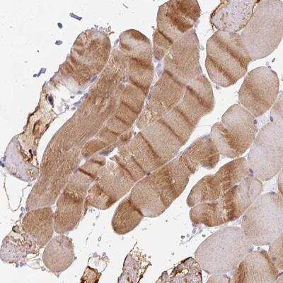 Immunohistochemistry-Paraffin: CACNA1S Antibody [NBP2-33799]