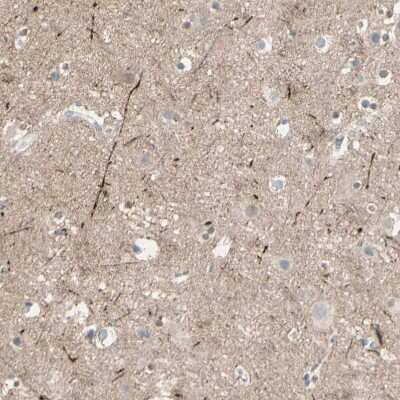 Immunohistochemistry-Paraffin: CACNA2D1 Antibody [NBP1-86683]