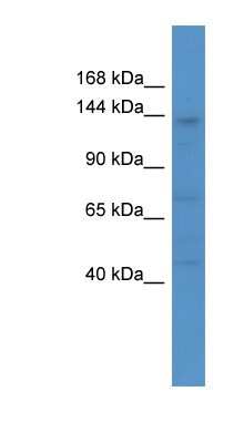 Western Blot: CACNA2D4 Antibody [NBP1-68992]