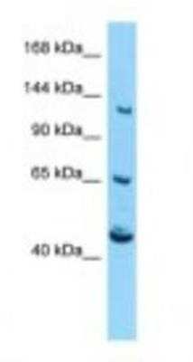 Western Blot: CACNA2D4 Antibody [NBP1-98469]