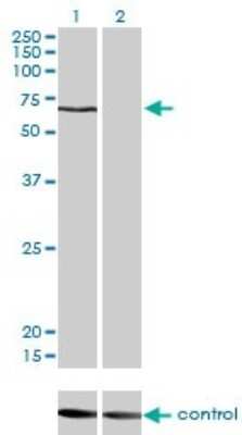 Western Blot: CACNB1 Antibody (1G6) [H00000782-M01]