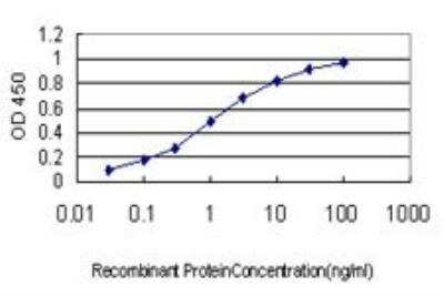 ELISA: CACNB2 Antibody (6C1) [H00000783-M01]