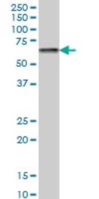 Western Blot: CACNB2 Antibody (6C4) [H00000783-M05]