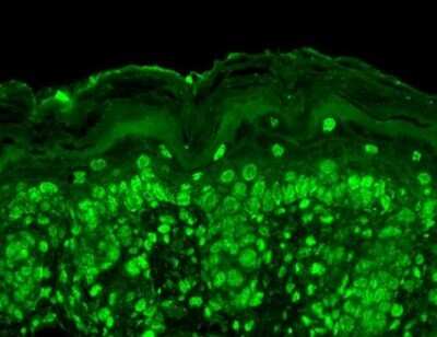 Immunohistochemistry: CACNB2 Antibody (N8b/1) [NBP1-47607]