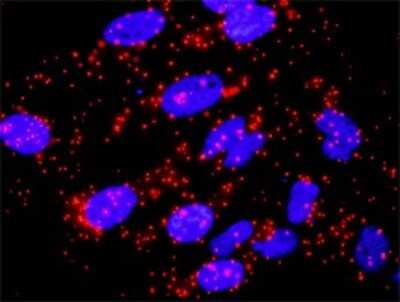 Proximity Ligation Assay: CACYBP Antibody (2E3) [H00027101-M01]