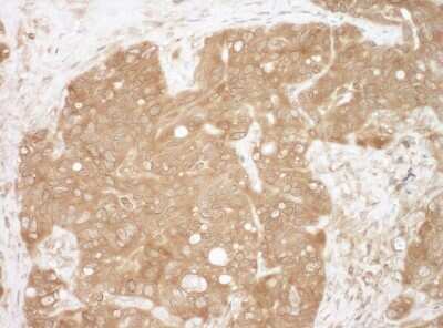 Immunohistochemistry: CACYBP Antibody [NBP1-49922]